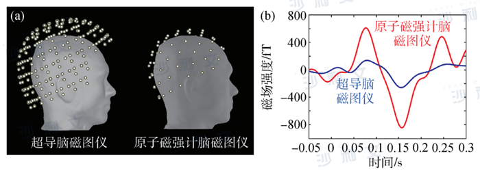 医疗观察丨解密大脑活动，脑磁图引领脑科学研究新热点