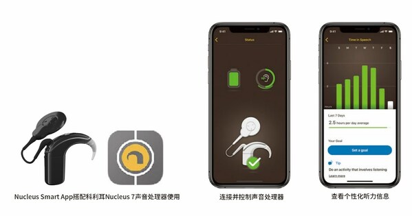 移动互联时代专属人工耳蜗科利耳N7声音处理器----一机掌控，高效管理